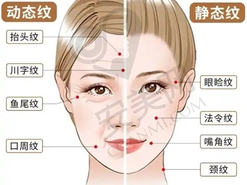 刘月更医生面部年轻化综合方案