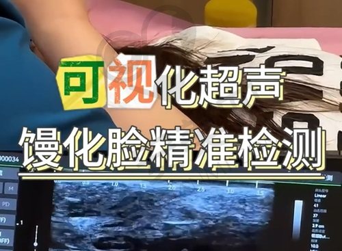北京艺美硕德整形医院怎么样？