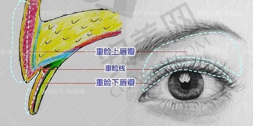 北京丰联丽格师丽丽双眼皮做得好吗？