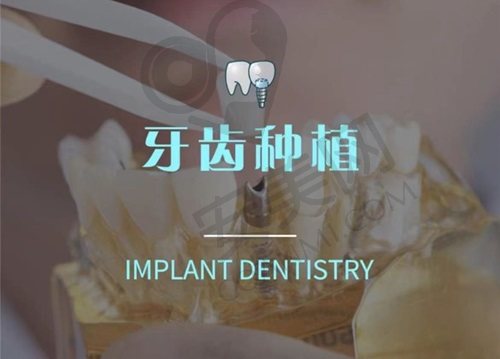 上海雅悦齿科种植牙2025年多少钱一颗？