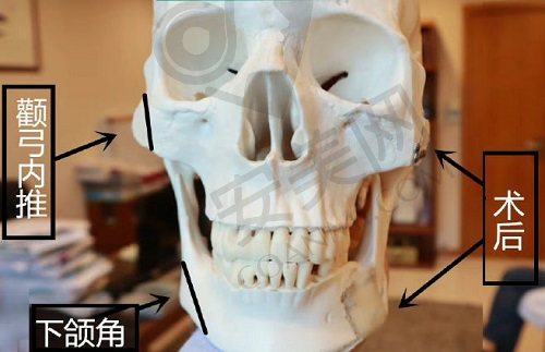 沈阳杏林朱石江颌面手术怎么样？