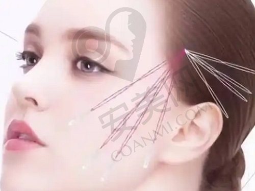亲历成都素美李建刚筋膜提升