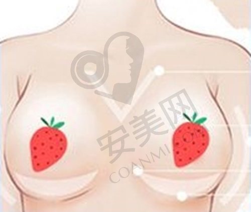 北京美莱于双全医生隆胸技术怎么样？