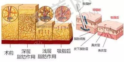 广东韩妃整形外科医院擅长项目