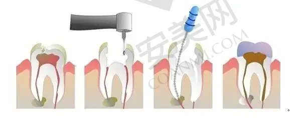 2023乌鲁木齐烤瓷牙冠修复口腔医院top10强强榜(乌鲁木齐美奥口腔优先入围)