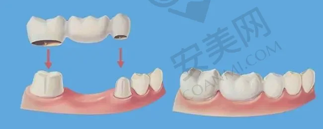 荆州美傲整形医院门诊有哪些擅长的项目？