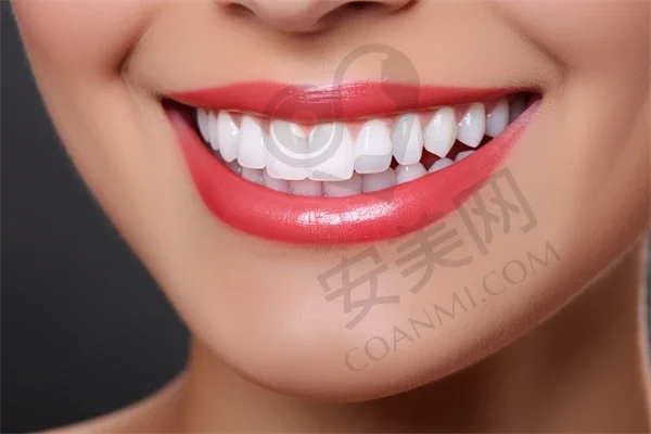 隐适美隐形矫正适合哪些人群？
