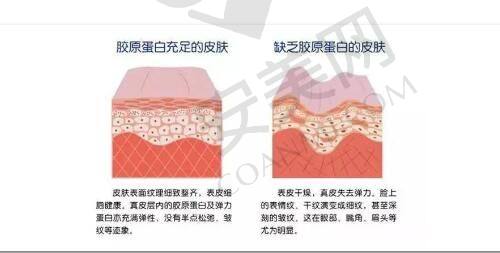 如何选择适合自己的中山韩妃双眼皮整形医生？