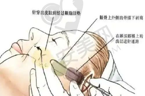 邯郸京美和华美医院的术后成效和口碑如何？