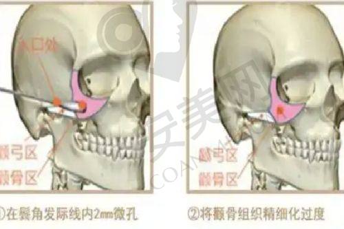 邯郸京美医院的医生服务态度怎么样？