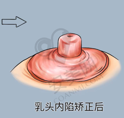 新疆威兹曼整形外科医院的优势总结