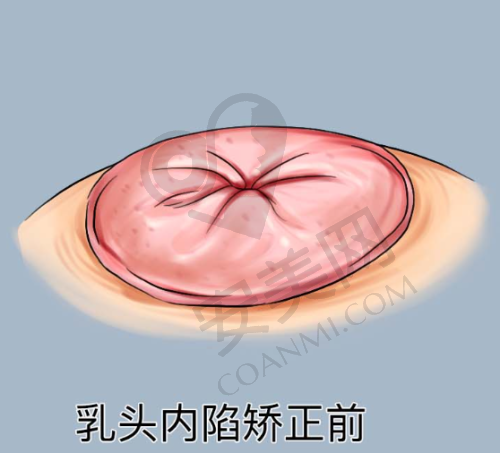 总结