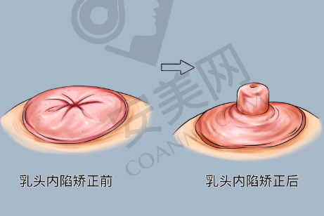 总结