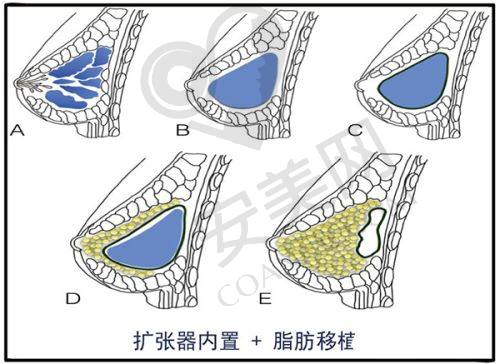 如何预约上海丽质卢九宁医生的人中缩短术？