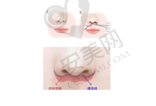 北京丽星翼美医疗美容