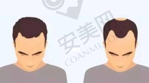 总结