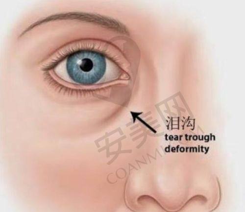 小耳症治疗的过程是怎样的？
