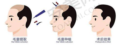 济南诺德医疗美容医院的地址和电话背后的服务保护如何？