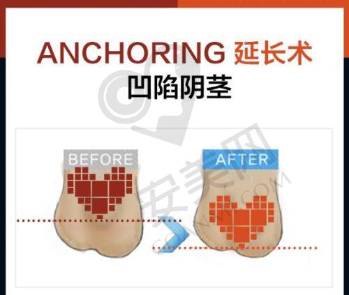 合肥华美朱德刚院长怎么样？