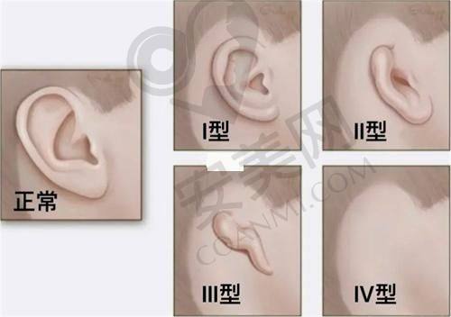 医生是如何诊断我的剖腹产疤痕的？