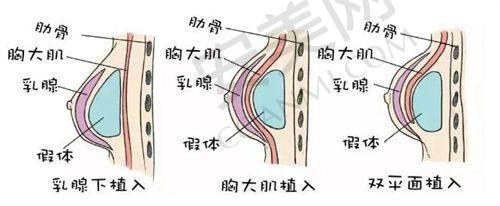 烟台壹美天成医疗美容医院正规吗？