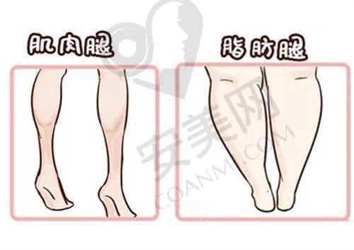 小耳症治疗对患者的生活有哪些影响？