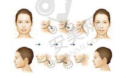 赣州韩美整形美容医院植发科