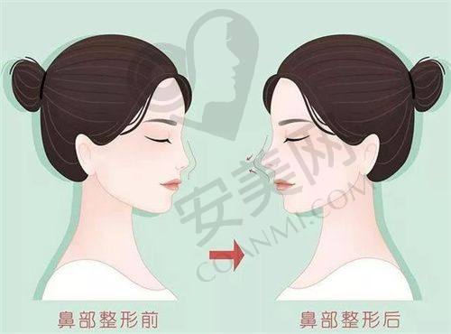 价格参考与实际情况：注意事项