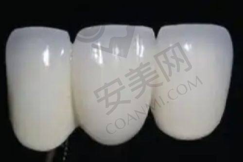 总结