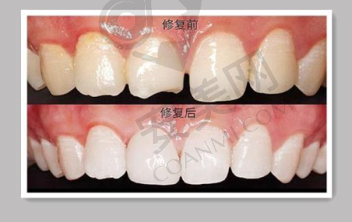 为什么选择兰州海涛口腔医院