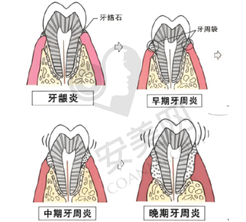 韩国仕诺康种植牙的适用人群有哪些？