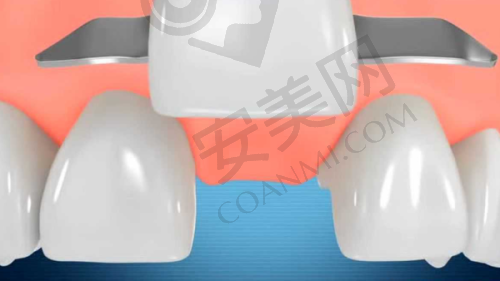 宜春施美尔口腔的诊疗项目有哪些？