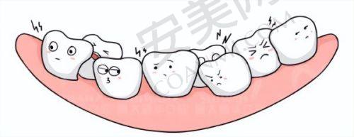 美加牙贴面的治疗过程是怎样的？