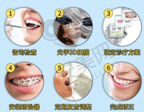 运城运中口腔牙齿根管治疗的特色在哪里？