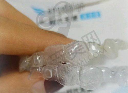 如何选择适合自己的矫正方案