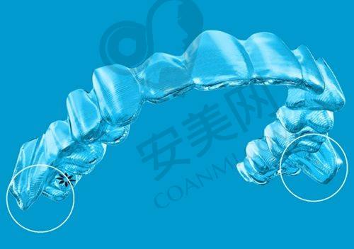 全瓷牙冠修复的初诊情况是怎样的？