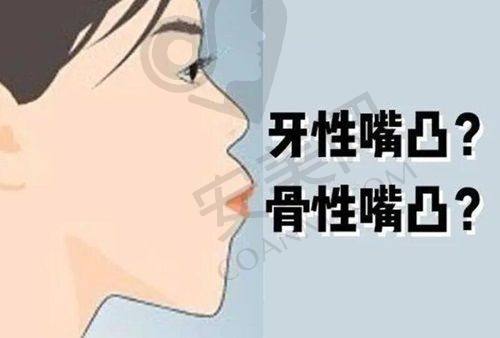 为什么选择运城运中口腔进行根管治疗？