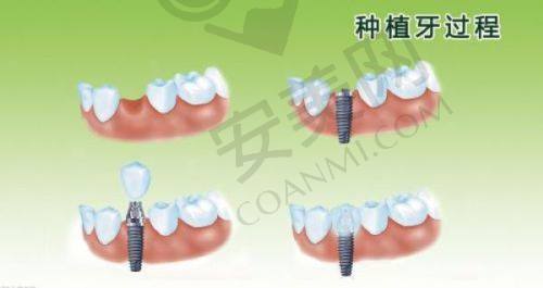 徐州美奥口腔窦方伟医生怎么样