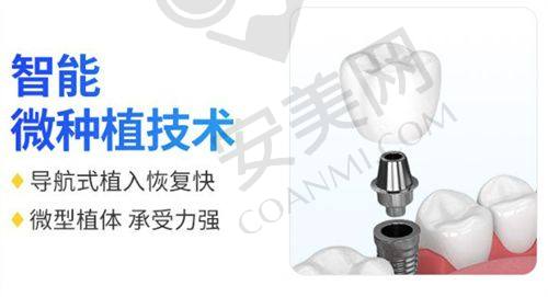 半口种植牙有哪些优势？