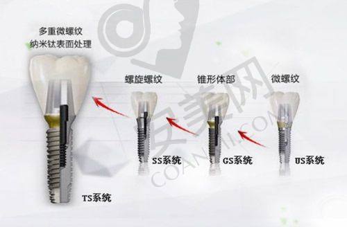 宜春施美尔口腔的医生团队如何？