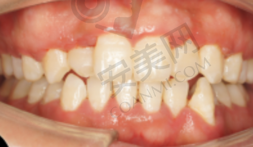 徐州美奥口腔的评价如何？