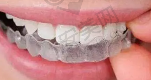 南京溧水瑞齿固德口腔的特色技术是什么？