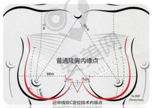 广州艺星与其他医美机构相比有什么优势？