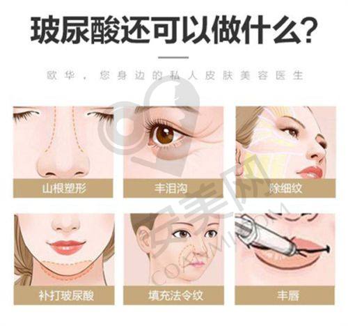 术后护理对于济南诺德灵韵BoBo双眼皮成效有什么影响？