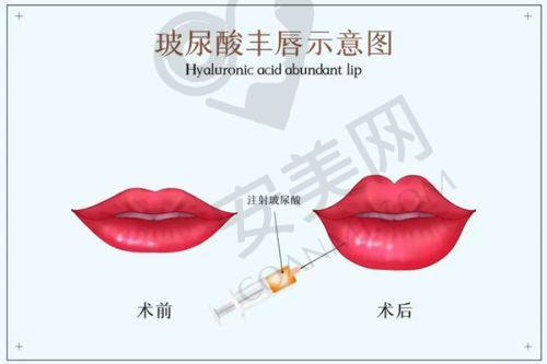 祛黑毛痣：按面积收费的治疗项目
