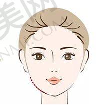 合肥维多利亚整形医院的鼻部整形医生有什么独特之处？