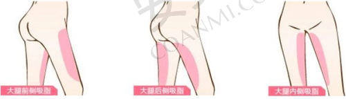医美项目种类对比，合肥华美和艺星谁的项目更丰富？