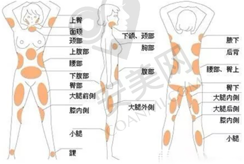 如何选择合适的植发套餐：综合考量自身情况