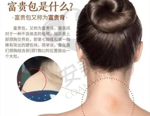 选择筋膜提升医院的注意事项