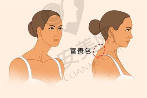成都八大处医院小耳症治疗费用是如何构成的？